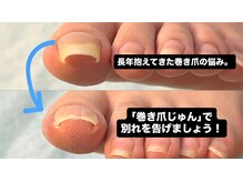 巻き爪じゅん 千葉駅前店