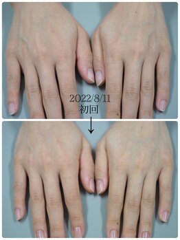 ネイル キャンバス シルヴァ(Nail Canvas Silva.)/ルビッシュの効果!