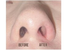 メローワックス 松本駅前店(MELLOW WAX)/鼻毛ワックス☆