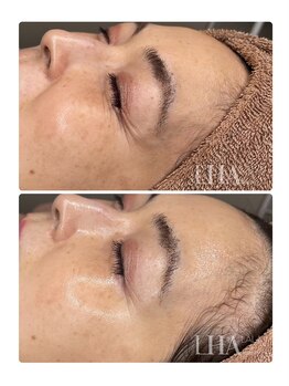 ラディアント たまプラーザ/「ララピール」ビフォーアフター