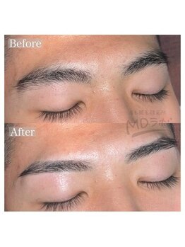 エムディラボ 金沢竪町店(MDラボ)/眉毛wax BeforeAfter