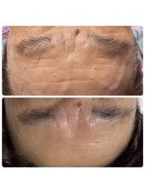 バイオ スキン プラス(Bio Skin Plus)/70代になっても若々しくいたい！