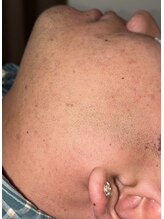 ベルフィオーレ(bel fiore)/20代男性　初回