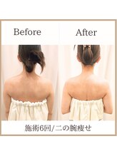 サロンルーチェ(Salon Luce)/ブライダルエステ/施術回数6回