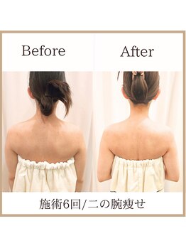 サロンルーチェ(Salon Luce)/ブライダルエステ/施術回数6回