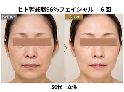 グラツィア(Grazia)の写真