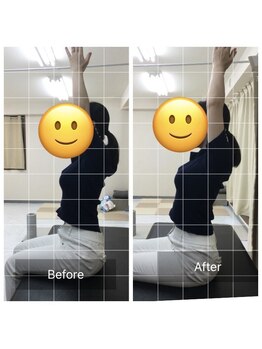 ナオル整体 センター南院(NAORU整体)/肩こりのBefore After