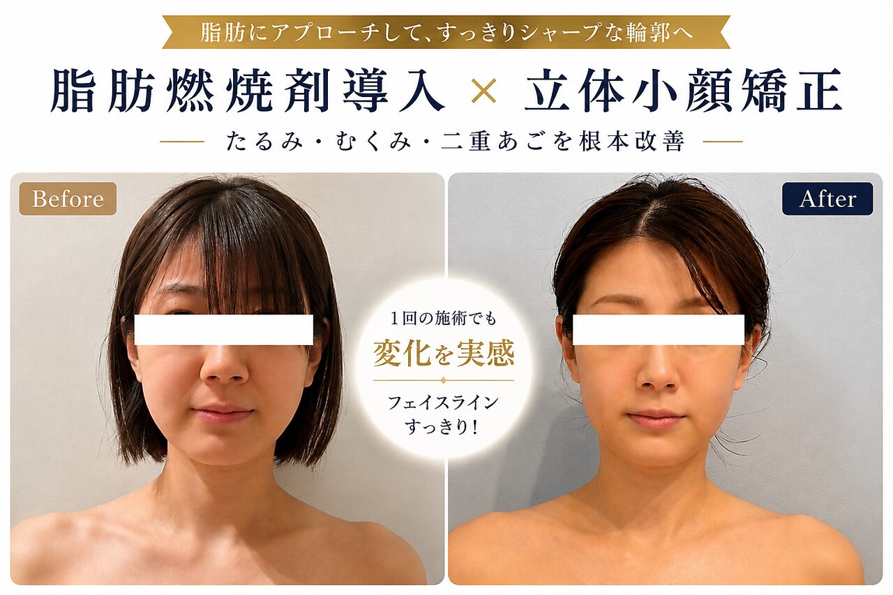値下げしました！エステサロン　EMS 大阪市でEMSが人気のエステサロン｜ホットペッパービューティー