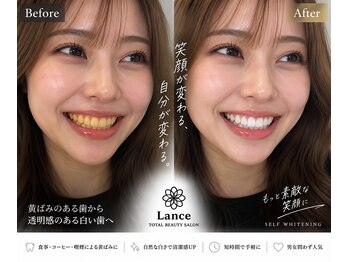 ランス 天神今泉店(Lance)/【どちらの方が印象いいですか】