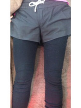 ウルオス/脚のむくみもここまで解消!