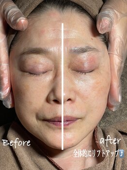 アデージョ(Adejio)/WAXXXX