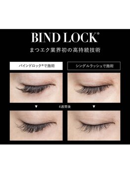 アイリー(i’rry)/バインドロックは持続力が圧倒的