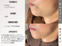 ルディラ 横浜店/インモードFX＋FORMA