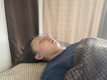 東京鍼灸整骨院の雰囲気（お悩みに合わせた美容鍼コースがオススメです！）