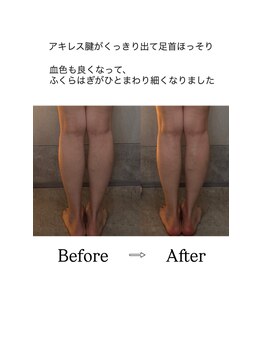 クリスタリオサーナエヌ 自由が丘(crystallo Sana N)/ふくらはぎ細くなりたい方必見!
