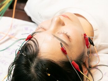 うかい鍼灸整体院の写真/《美容鍼で肌質改善》SNSで話題の美容鍼で肌の深部にアプローチ！化粧水のなじみもUP★