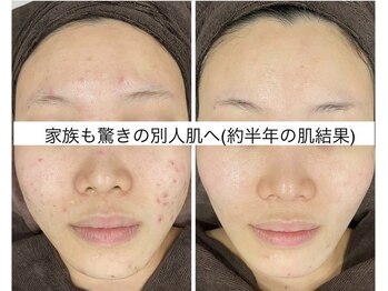 サードプレイス(3rd Place)/2階：エステ症例