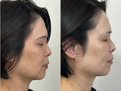 モモラ(Spa MoMora)の写真