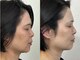 モモラ(Spa MoMora)の写真