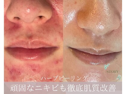 ストーリー 沼津店(STORY)の写真