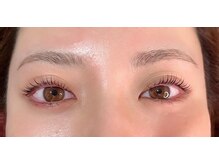 ボラード(boulard)/ペッタBig