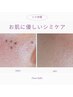 全員【シミ改善☆美肌エステ】シミケア20分あて放題+ビタミンC導入 ¥8,800