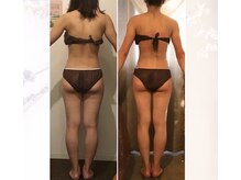 ビープロデュース 国分寺店(B' PRODUCE)/ビフォーアフター