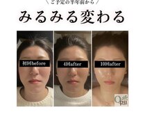 キュープ 北千住店(Qpu)