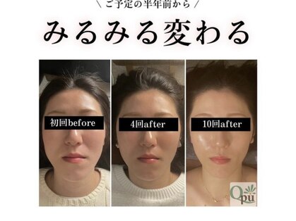 キュープ 北千住店(Qpu)の写真