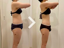 痩身&ブライダルエステサロン MillS 小倉店【3/2 NEW OPEN（予定）】/ダイエットビフォーアフター