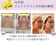 クリニカルエステ イーズ 広島祇園店の写真/【フェイシャル】レモンボトル×ヒト幹細胞コース￥16500→￥8800★気になるところにダイレクト注入♪小顔!