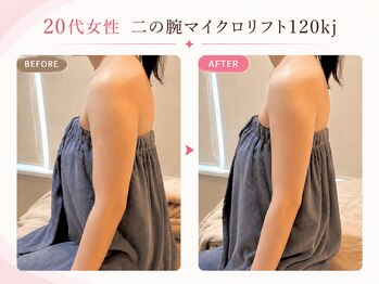 リフト 西船橋(Lift)/【西船橋】小顔・痩身専門店Lift