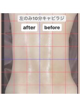 フラットベリー 恵比寿(Flat BELLY)/お施術ビフォーアフター