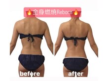 ティパニボーテ(Tipani Beaute')/Reborn痩身