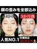 人気No.1【すぎうら指名料込】あご＋頭蓋骨小顔矯正【顔の歪み全部込み】体験