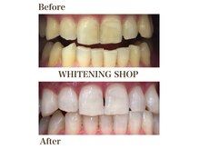 回数券使用後のビフォーアフター