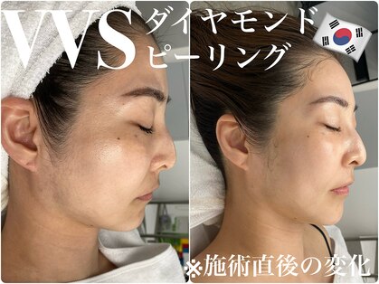 アリィ(Alii hisaya)の写真