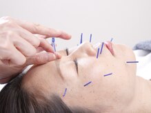 グリーンルーム鍼灸治療院