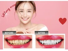 エクシアホワイト 立川南口店/当店人気ナンバー１