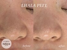 ナルカ(naluca)/【堺市・中百舌鳥】ララピール