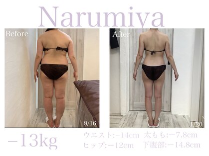 トータルチェンジエステ ナルミヤ(total change esthe Narumiya)の写真