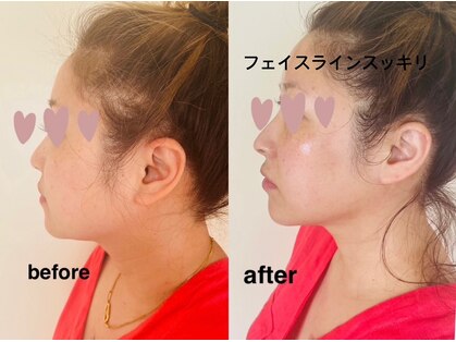 リエズ ハウス(Rie’s house)の写真