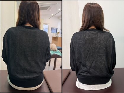 西宮ヤノ整骨院の写真