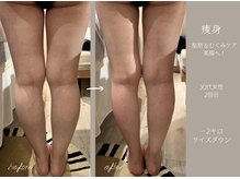 アールエスト(R EST.)/美脚、美BODY☆