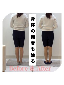 スタイルラボ高松/産後骨盤矯正の効果♪