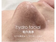 アンノウン 姫路店(Unknown.)の雰囲気（血流からアプローチする小顔、肌質改善♪菌バランスを整え艶肌へ）