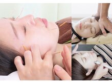 鷺沼駅前整骨院 鍼灸マッサージ院/選べる美容メニュー