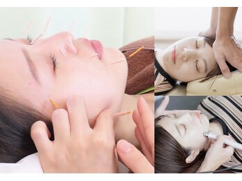 鷺沼駅前整骨院 鍼灸マッサージ院/選べる美容メニュー