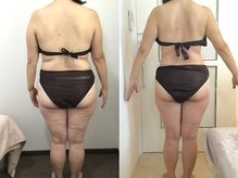 ウェリナ 一宮院/.【ダイエットbefore→after】