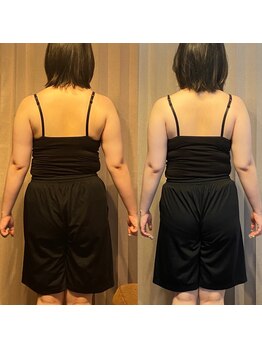 テマモリ(temamori)/施術ビフォーアフター